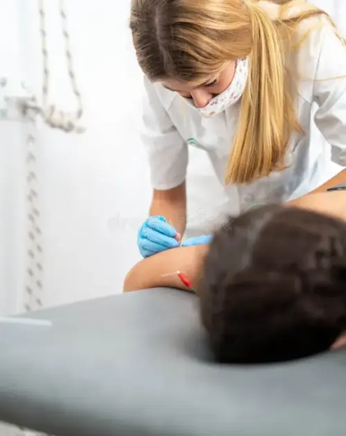 Acupuncture for heal all