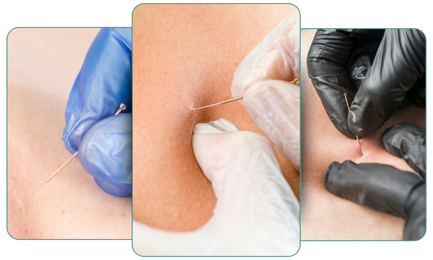 Our Pre and post natal by heal all Approach