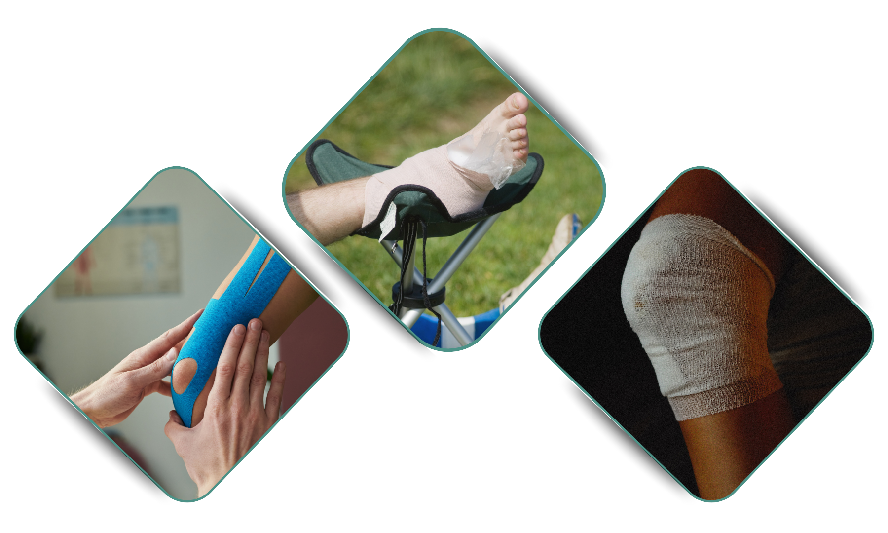 Sports Rehabilitation