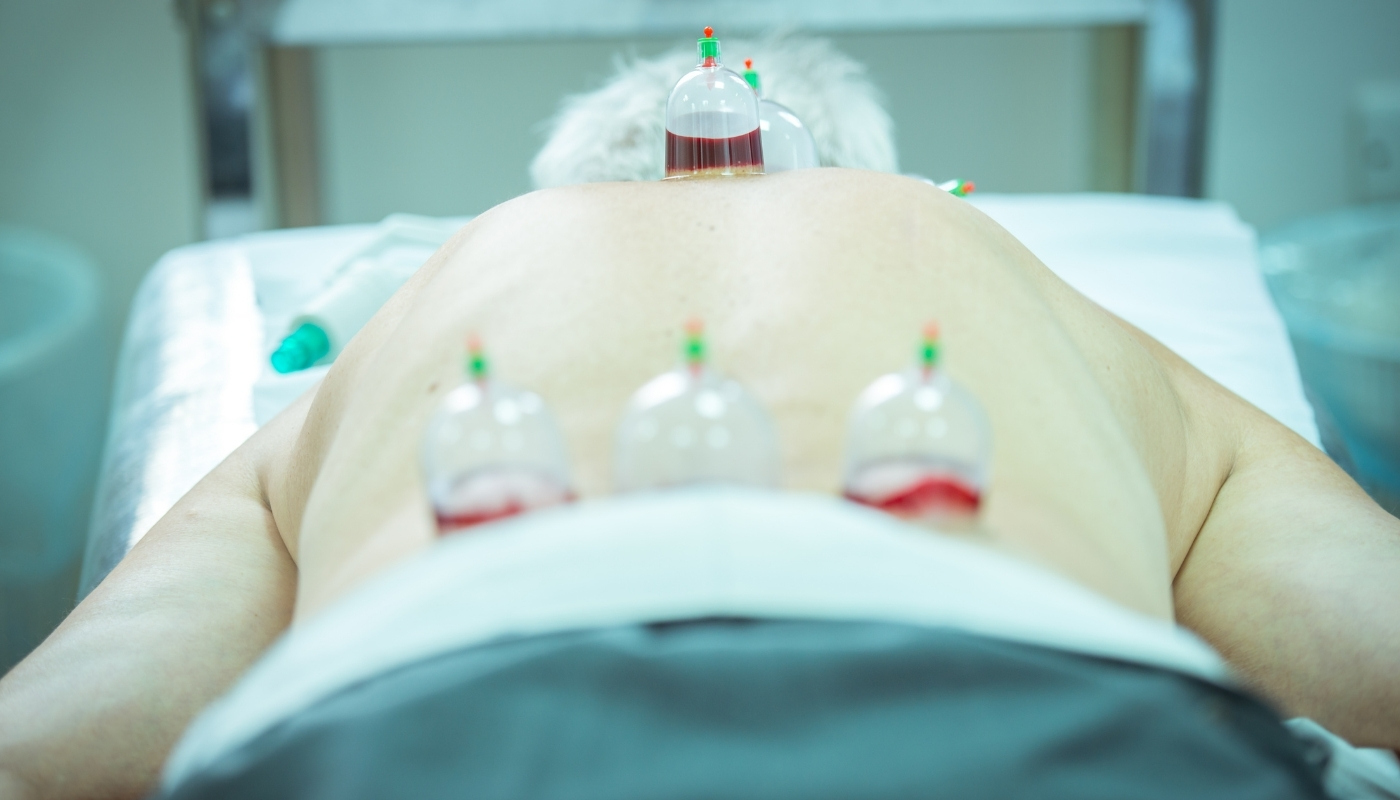 Targeted Cup Application for Cupping Therapy