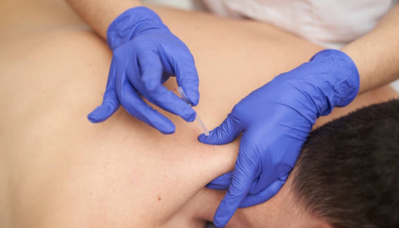 Targeted Needle Application