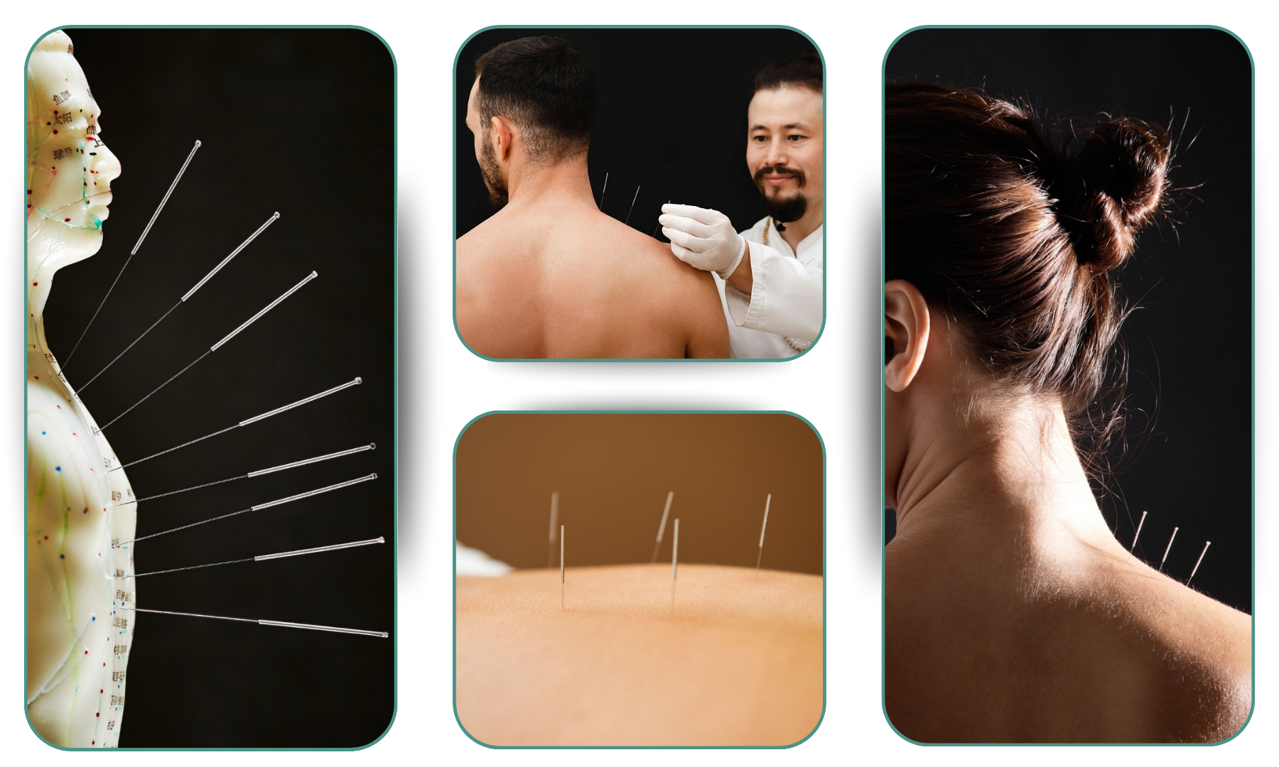 Why Acupuncture by heal all Works
