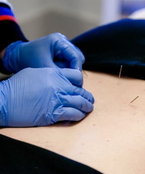 motionworks-nepean-acupuncture